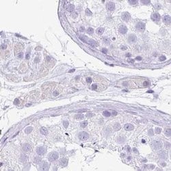 Invitrogen ZG16 Polyclonal Antibody 100 &mu;L; Unconjugated:Antibodies,
