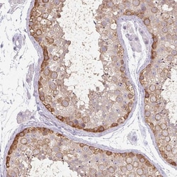 Invitrogen MAGEC3 Polyclonal Antibody 100 &mu;L; Unconjugated:Antibodies,