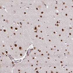 Invitrogen U2AF1 Polyclonal Antibody 100 &mu;L; Unconjugated:Antibodies,