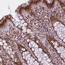 Invitrogen ARL6IP4 Polyclonal Antibody 100 &mu;L; Unconjugated:Antibodies,