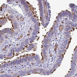Invitrogen TTC30A Polyclonal Antibody 100 &mu;L; Unconjugated:Antibodies,