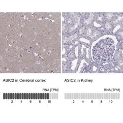 ASIC2 Polyclonal Antibody:Antibodies, Polyclonal