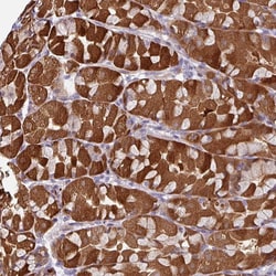 Invitrogen C2orf16 Polyclonal Antibody 100 &mu;L; Unconjugated:Antibodies,