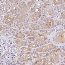 Invitrogen Factor XIII B Polyclonal Antibody 100 &mu;L | Buy Online | Invitrogen&trade; | Fisher Scientific