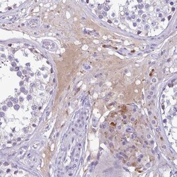 Invitrogen Factor XIII B Polyclonal Antibody 100 &mu;L | Buy Online | Invitrogen&trade; | Fisher Scientific