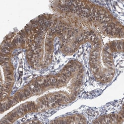 Invitrogen C7orf26 Polyclonal Antibody 100 &mu;L; Unconjugated:Antibodies,