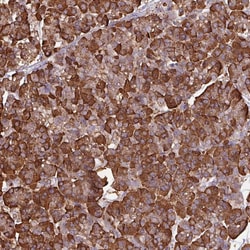 WBSCR22 Polyclonal Antibody:Antibodies, Polyclonal