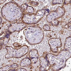 Invitrogen RPP25L Polyclonal Antibody 100 &mu;L; Unconjugated:Antibodies,
