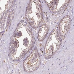 Invitrogen RPP25L Polyclonal Antibody 100 &mu;L; Unconjugated:Antibodies,