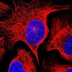 Invitrogen VPS25 Polyclonal Antibody 100 &mu;L; Unconjugated:Antibodies,