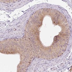 Invitrogen VPS25 Polyclonal Antibody 100 &mu;L; Unconjugated:Antibodies,