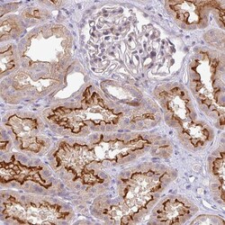 Invitrogen PIK3R5 Polyclonal Antibody 100 &mu;L; Unconjugated:Antibodies,