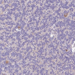 Invitrogen SLC38A1 Polyclonal Antibody 100 &mu;L; Unconjugated:Antibodies,
