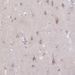 Invitrogen SLC38A1 Polyclonal Antibody 100 &mu;L; Unconjugated:Antibodies,