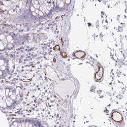 Invitrogen BTD Polyclonal Antibody 100 μL; Unconjugated:Antibodies,