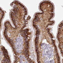 Invitrogen TMEM253 Polyclonal Antibody 100 &mu;L; Unconjugated:Antibodies,