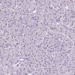 Invitrogen CMTM5 Polyclonal Antibody 100 &mu;L; Unconjugated:Antibodies,