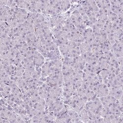 Invitrogen CMTM5 Polyclonal Antibody 100 &mu;L; Unconjugated:Antibodies,