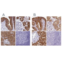 Invitrogen HGD Polyclonal Antibody 100 &mu;L; Unconjugated:Antibodies,