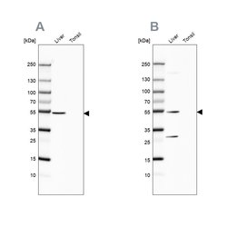Invitrogen HGD Polyclonal Antibody 100 &mu;L; Unconjugated:Antibodies,