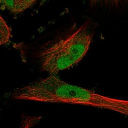 PDE1C Polyclonal Antibody:Antibodies, Polyclonal