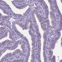 Invitrogen TTLL6 Polyclonal Antibody 100 &mu;L; Unconjugated:Antibodies,