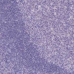 Invitrogen TTLL6 Polyclonal Antibody 100 &mu;L; Unconjugated:Antibodies,