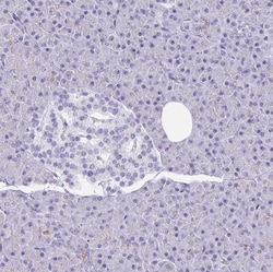 Invitrogen GSDMB Polyclonal Antibody 100 &mu;L; Unconjugated:Antibodies,