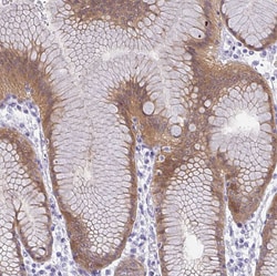 Invitrogen GSDMB Polyclonal Antibody 100 &mu;L; Unconjugated:Antibodies,
