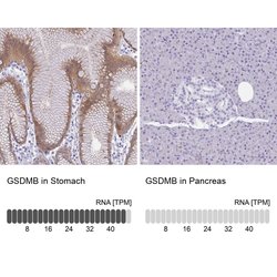 Invitrogen GSDMB Polyclonal Antibody 100 &mu;L; Unconjugated:Antibodies,