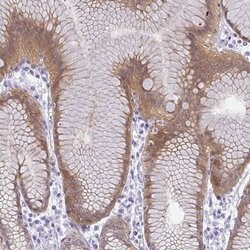 Invitrogen GSDMB Polyclonal Antibody 100 &mu;L; Unconjugated:Antibodies,