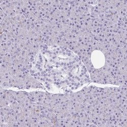 Invitrogen GSDMB Polyclonal Antibody 100 &mu;L; Unconjugated:Antibodies,