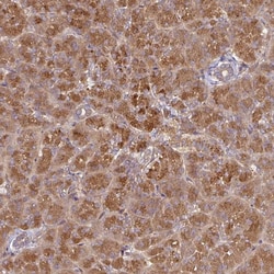 Invitrogen CEP95 Polyclonal Antibody 100 &mu;L; Unconjugated:Antibodies,