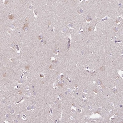 Invitrogen C4orf48 Polyclonal Antibody 100 &mu;L; Unconjugated:Antibodies,