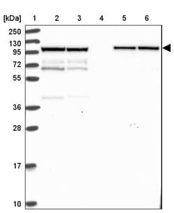 Invitrogen KLC1 Polyclonal Antibody 100 &mu;L; Unconjugated:Antibodies,