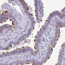 Invitrogen TTC30A Polyclonal Antibody 100 &mu;L; Unconjugated:Antibodies,