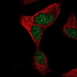 Invitrogen TTC30A Polyclonal Antibody 100 &mu;L; Unconjugated:Antibodies,