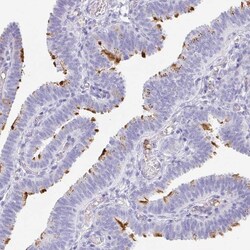 Invitrogen LDLRAD1 Polyclonal Antibody 100 &mu;L; Unconjugated:Antibodies,