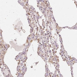 XAGE2 Polyclonal Antibody:Antibodies, Polyclonal