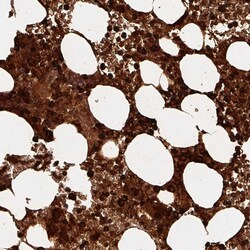 DEFA1 Polyclonal Antibody:Antibodies, Polyclonal
