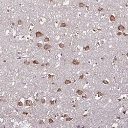Invitrogen RPL38 Polyclonal Antibody 100 &mu;L; Unconjugated:Antibodies,