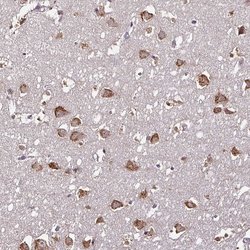 Invitrogen RPL38 Polyclonal Antibody 100 &mu;L; Unconjugated:Antibodies,