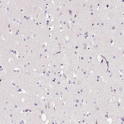 Invitrogen CYBASC3 Polyclonal Antibody 100 &mu;L; Unconjugated:Antibodies,