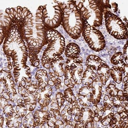 Invitrogen CYBASC3 Polyclonal Antibody 100 &mu;L; Unconjugated:Antibodies,