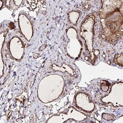Invitrogen FBXO34 Polyclonal Antibody 100 &mu;L; Unconjugated:Antibodies,