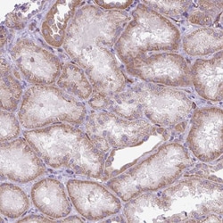 Invitrogen RNASE10 Polyclonal Antibody 100 &mu;L; Unconjugated:Antibodies,