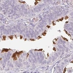 Invitrogen TMEM237 Polyclonal Antibody 100 &mu;L; Unconjugated:Antibodies,