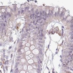 Invitrogen TMEM237 Polyclonal Antibody 100 &mu;L; Unconjugated:Antibodies,