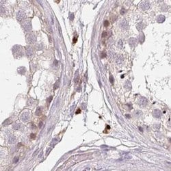 Invitrogen TMEM237 Polyclonal Antibody 100 &mu;L; Unconjugated:Antibodies,