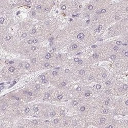 Invitrogen TMEM237 Polyclonal Antibody 100 &mu;L; Unconjugated:Antibodies,